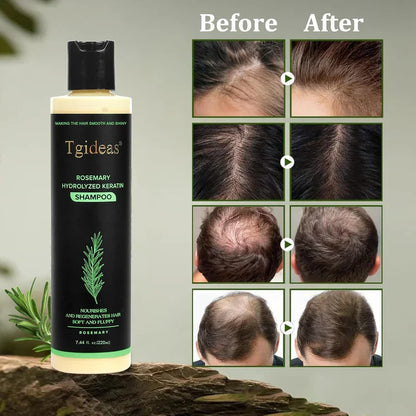 Tgideas® Rosemary Shampoo | Hair Growth & Scalp Treatment [Extra 55% OFF]