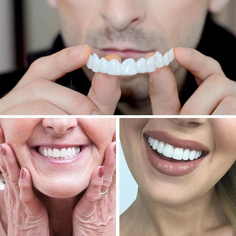 Snap On Smile Teeth Veneers
