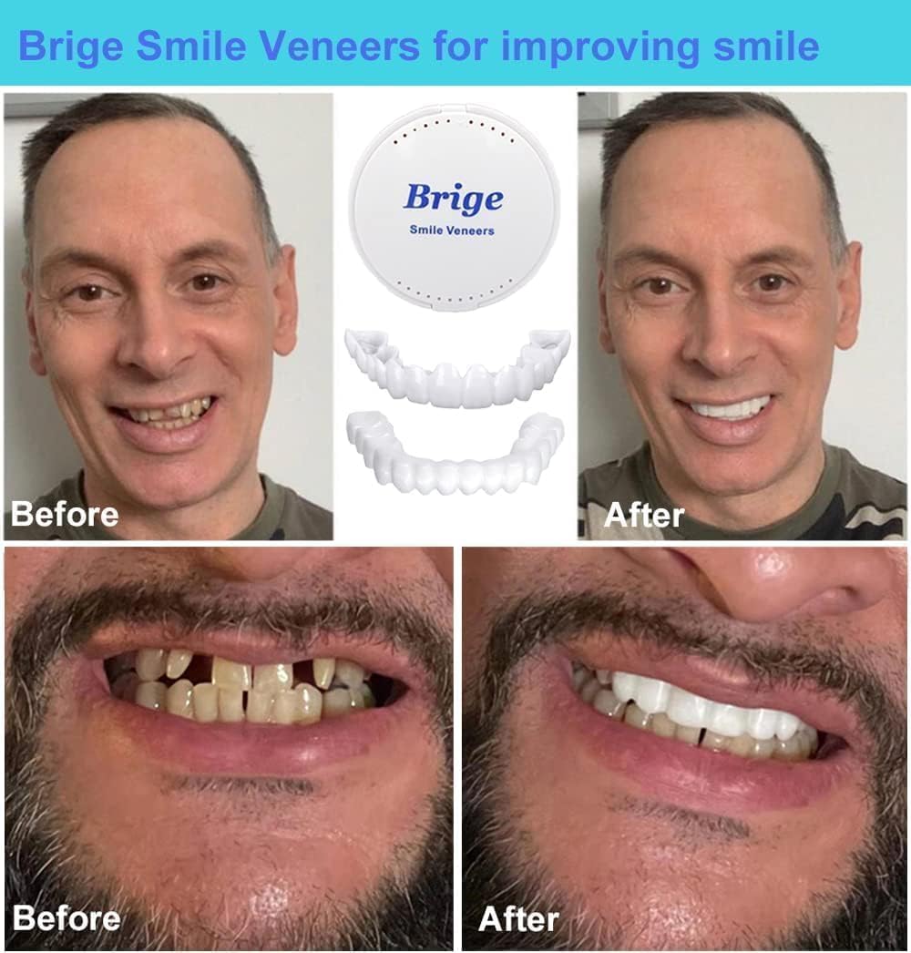 Snap On Smile Teeth Veneers