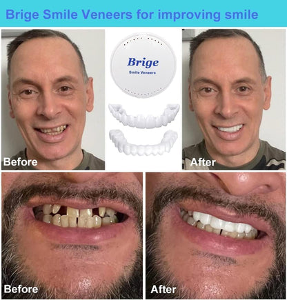 Snap On Smile Teeth Veneers